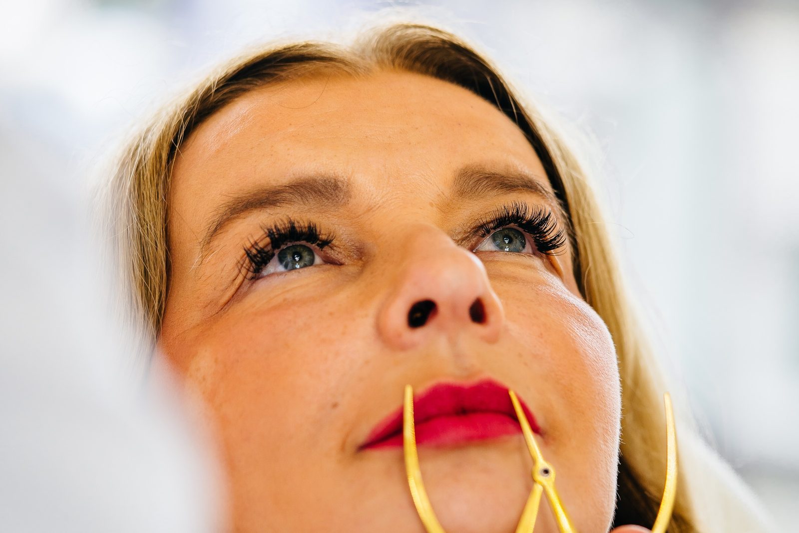 Vermessung der Lippenproportionen vor einer Hyaluron-Behandlung